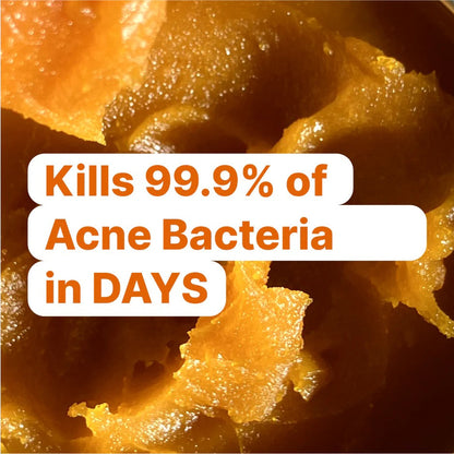 Norse Organics Redness & Breakout Support Ritual