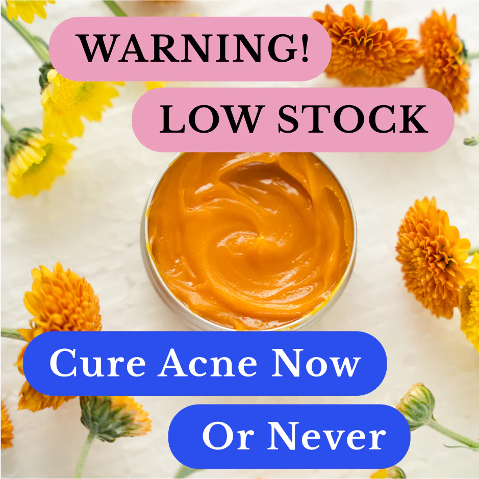 Norse Organics Redness & Breakout Support Ritual